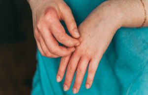 Rheumatoid Arthritis: Symptoms And Causes,